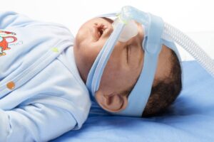 Infant CPAP